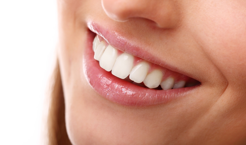 Teeth Whitening