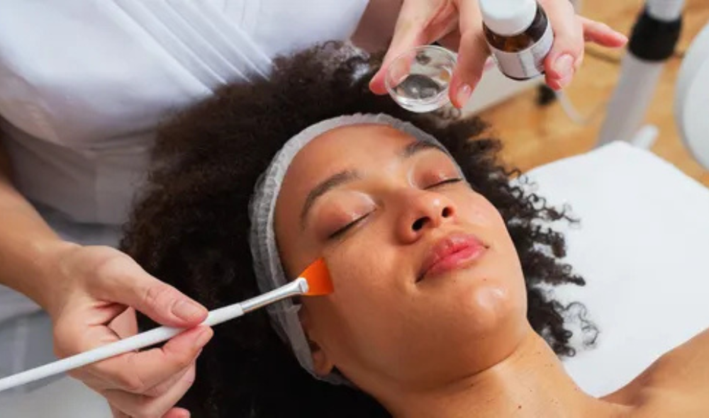 Chemical peels facial