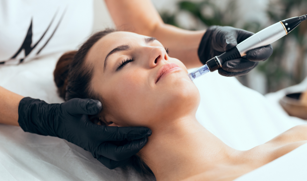 Microneedling Facial